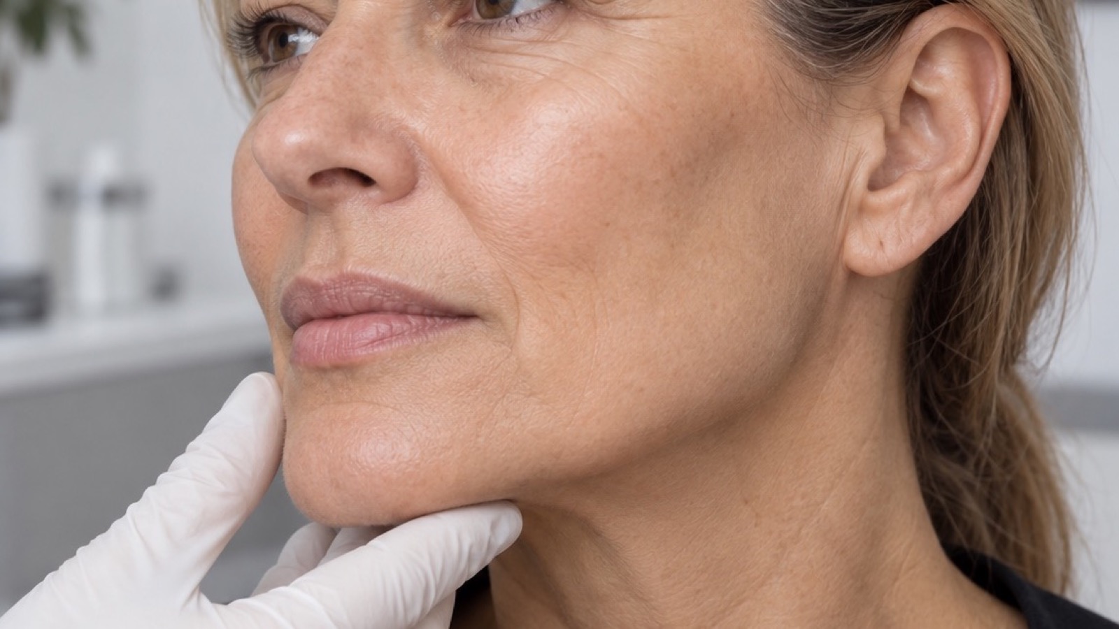 Facial volume assessment — AI-generated image